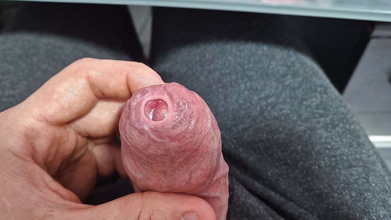Neporezana Uska Fimoza Kurac Precum Zavodljivanje za Ljubitelje Prepucija S Izbacivanjem Sperme