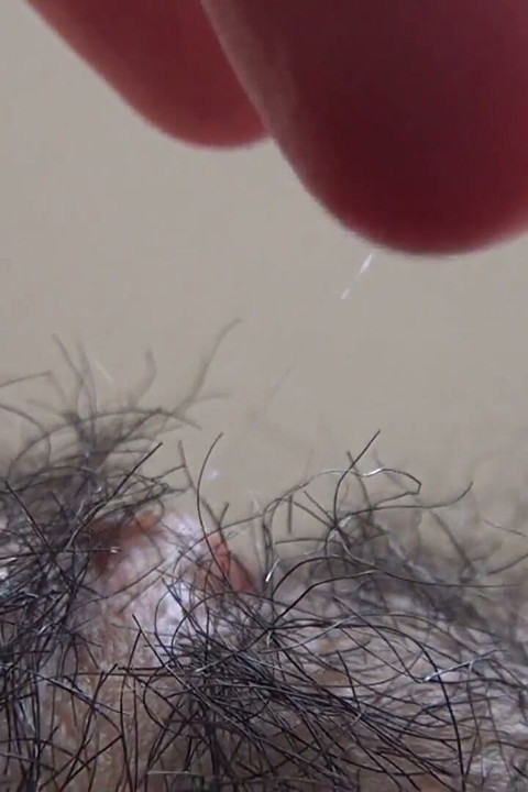 The Mound of the Clitoris