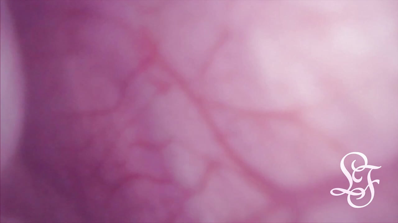 Bulge INSIDE my Bladder from Anal