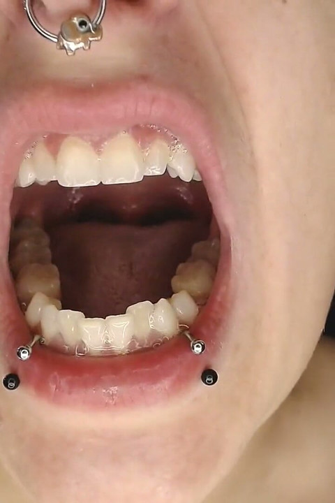 Climb Inside Wide Open Teeth Tongue Mouth Show