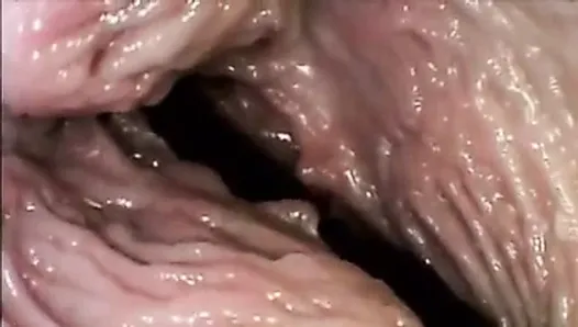 Inside vagina