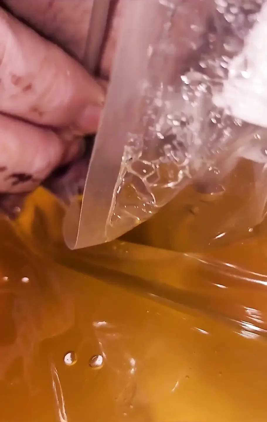 瘫痪问题101：我必须用导尿管引流, 因为我的膀胱没有释放
