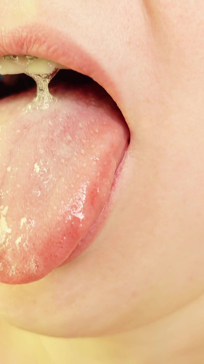 Powerful moment from "braces mouth tour video - vore fetish"