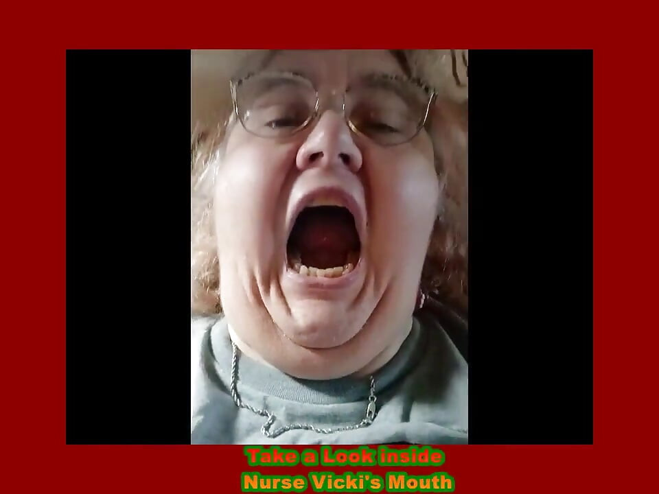 Requested Video Look Inside My Mouth
