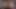 Asian Teen Raya Ngueyn Piss Hole Gets Penetrated With Surgical Steel Sounds By Doctor Tampa Raya Pham Raya Khai Raya Bennett
