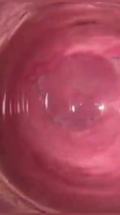 Camera in Vagina, Cervix POV, Creampie | Clip 1