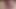 shaved-girl 14