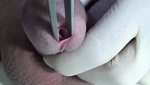 Speculum 4