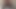 Anal germe buttplug büyük oyuncak göt yapay penis şaşkın