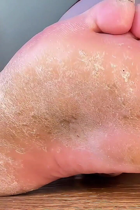 Toe Jam Tease, μεγάλα πόδια, βρώμικα πέλματα & Cum Countdown Feet JOI Bella Blast