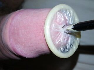 Prezervatifin üretra derlemesine yuvarlanması, üretral sondaj