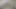 LizzyYum VR december 20 2023 Post Op Orgasm Pussy Masturbation Teasing