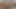 Lizzy Yum July 2023 JUST MONDAY Post-Op Orgasm Pussy Clit Masturbation Teasing Orgasm