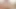 Lizzy Yum June 2023 Just My Clit 2 Post Op Orgasm Pussy Clit Masturbation Teasing Orgasm