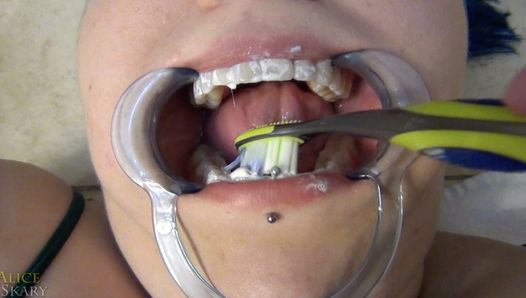 Zahnarzt sondiert den Mund des frechen Mädchens