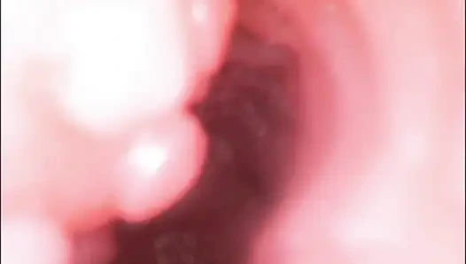 Endoscope Creampie. Cam Inside Pussy Shows Dick Cumming Inside Pussy