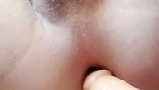 anal