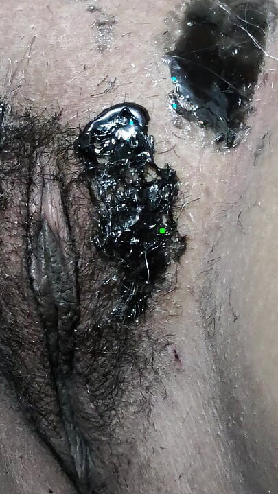 Pussy waxing with hot 🥵 wax