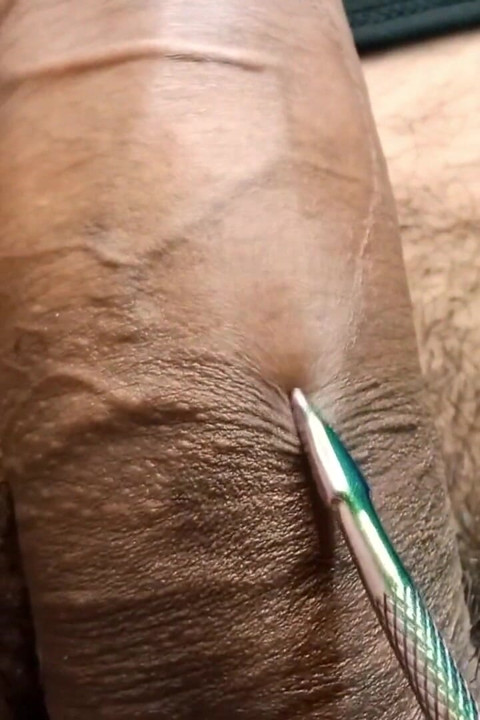 My Stepsister Wants to Try Something Metallic on My Foreskin, It's Very Exciting!