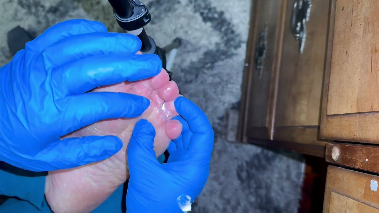 Crusty Foot Care and Worship - FTM