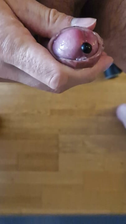 Διαστολή ουρήθρας με σιλικόνη