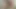 siyah yapay penis ile prostat sağma Nisan-06-2015