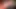 Belly Button Rumor