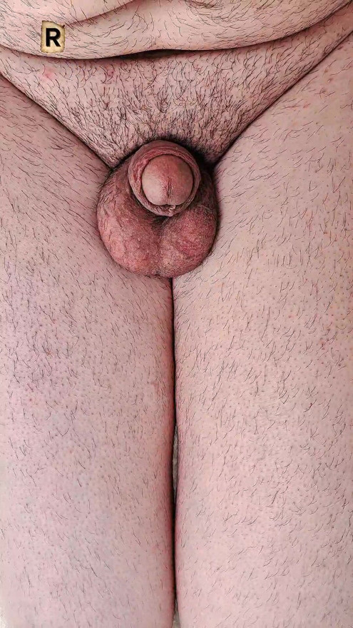 My wet penis is urinating."