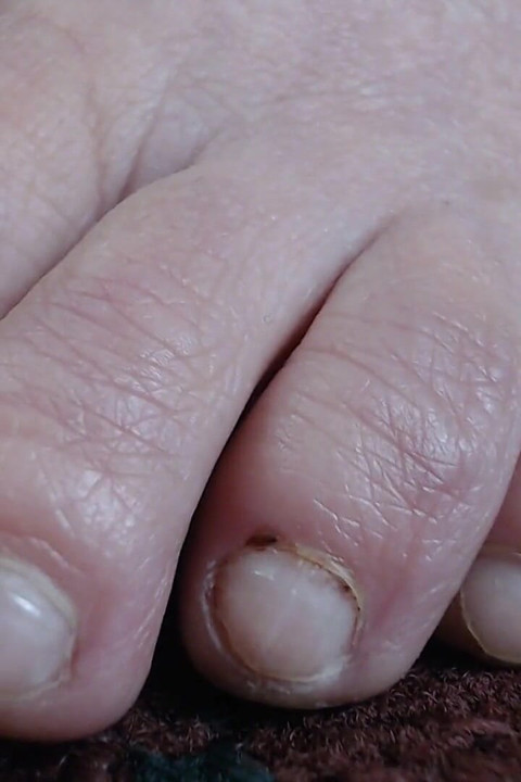 Closeup natural do dedo do