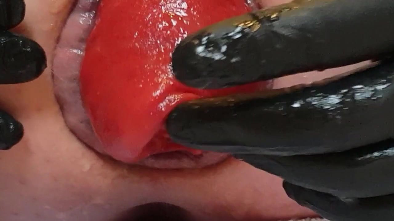 More prolapse