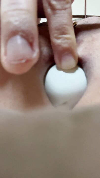 Ping pong ball in anus