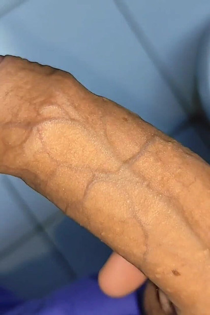 大きなペニスポンピングツリーコック静脈