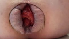 Asscunt'ım - küçük prolapsus için kabarık dudaklar