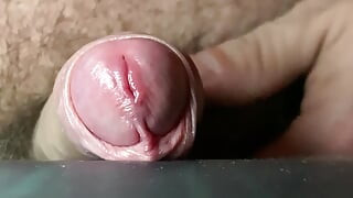 sperm