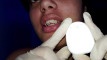 Pratinjau video