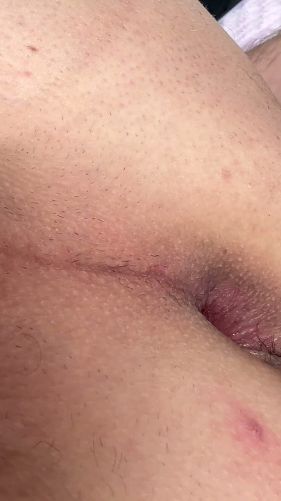 Gape Anus for Big Dildi