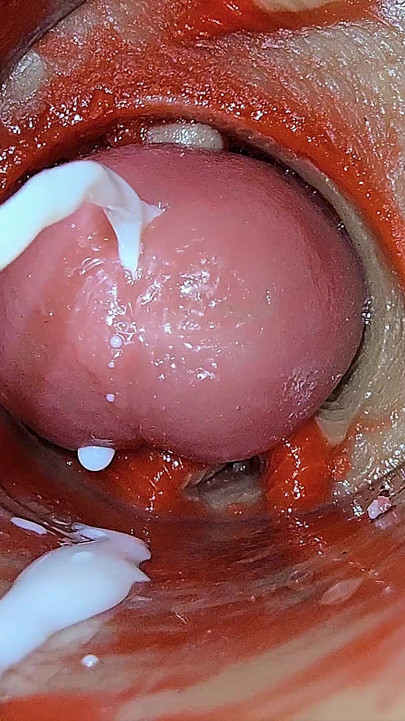 Camera Inside Deep Pussy Captures Overdose Ejaculation of Sperm Asmr
