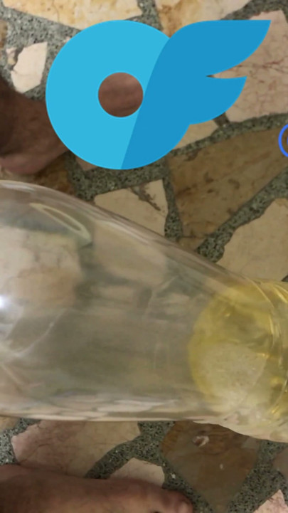 Urine Collection