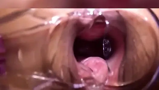 Banyak Bangern Diliat