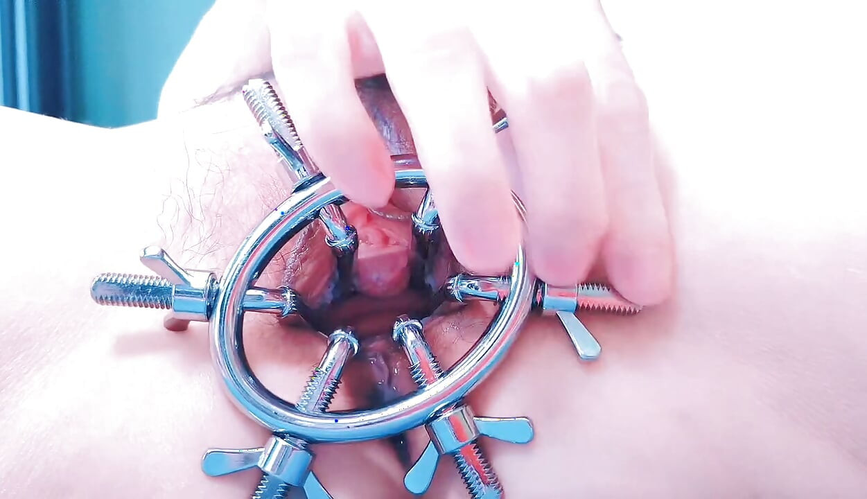 Speculum