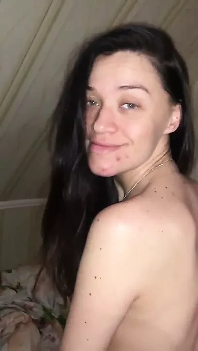 anal y01