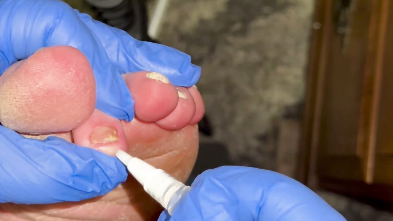 Crusty Foot Care and Worship - FTM