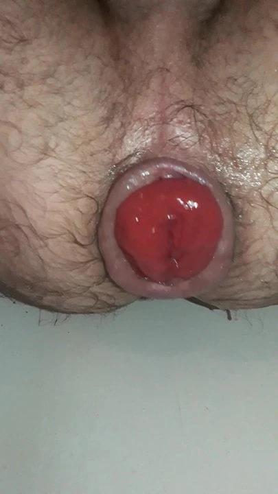 Ass prolapse