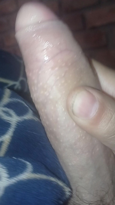 I masturbate in a park, do you want to see?