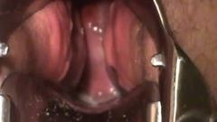 bbw masturbate with speculum show cervix contracting orgasm