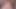 201709251