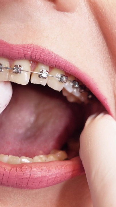 Must-see moment from "ASMR video: hot BRACES and double layer of medical nurse nitrile gloves (Arya Grander)"