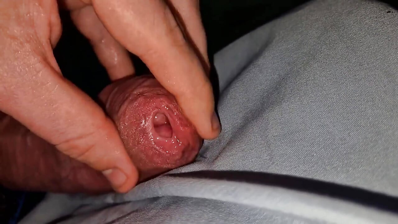 Geaderde en extreem natte phimosis forskin ongecensureerde piksessie