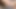 Deep Anal Masturbation Big Gaping Hot Anal Prolapse