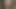 Abgebundene Titten und lange Nippel 2